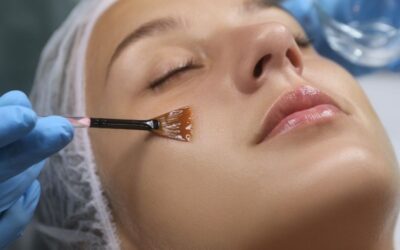 ¿Cuál es la diferencia entre peeling y exfoliación?