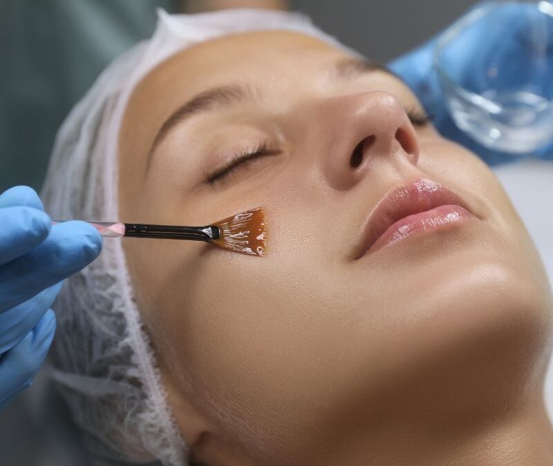 ¿Cuál es la diferencia entre peeling y exfoliación?